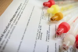 Ve Fakultní nemocnici Ostrava se můžete zdarma otestovat na HIV, žloutenku i syfilis